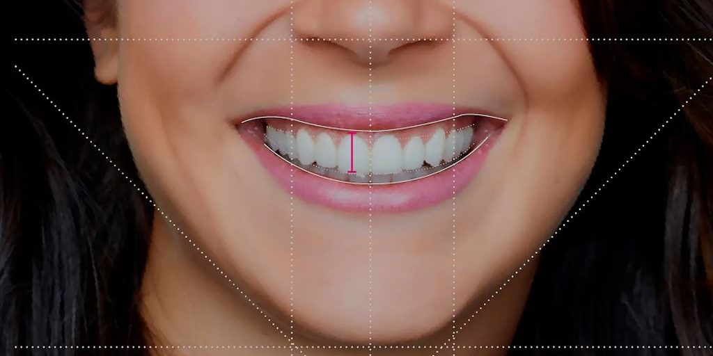 dentistica ou odontologia estetica