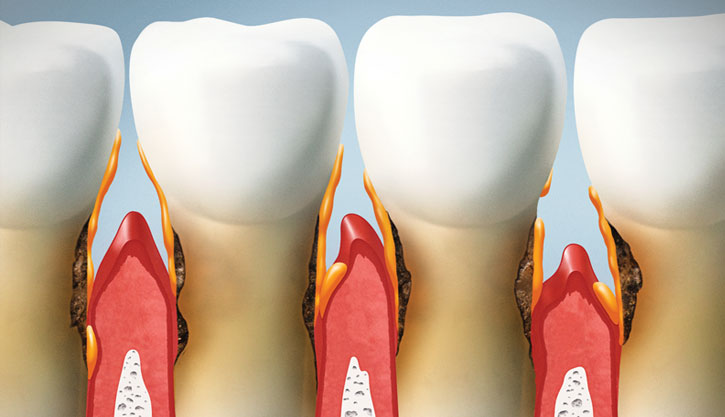 Periodontia