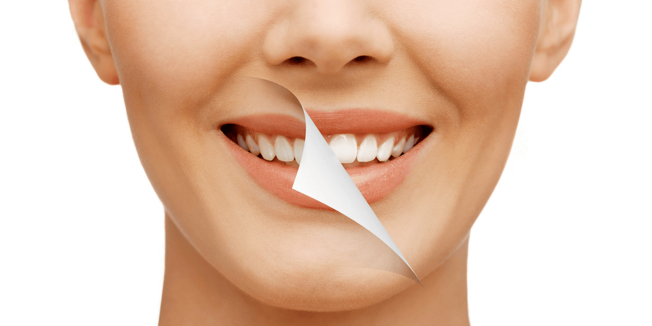 Beleza e saude dental no sorriso Procedimentos que trazem saúde e beleza