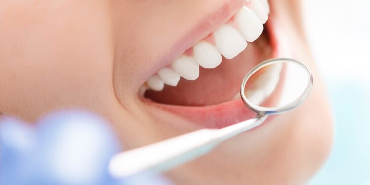 Consulta ao dentista para prevenção de doenca bucal