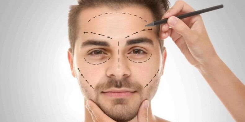 Harmonização Facial Masculina