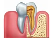 O papel das células-troco dental